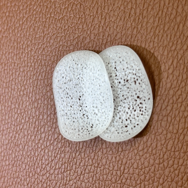 What Common Issues Arise with MBBR Systems and How to Resolve Them?