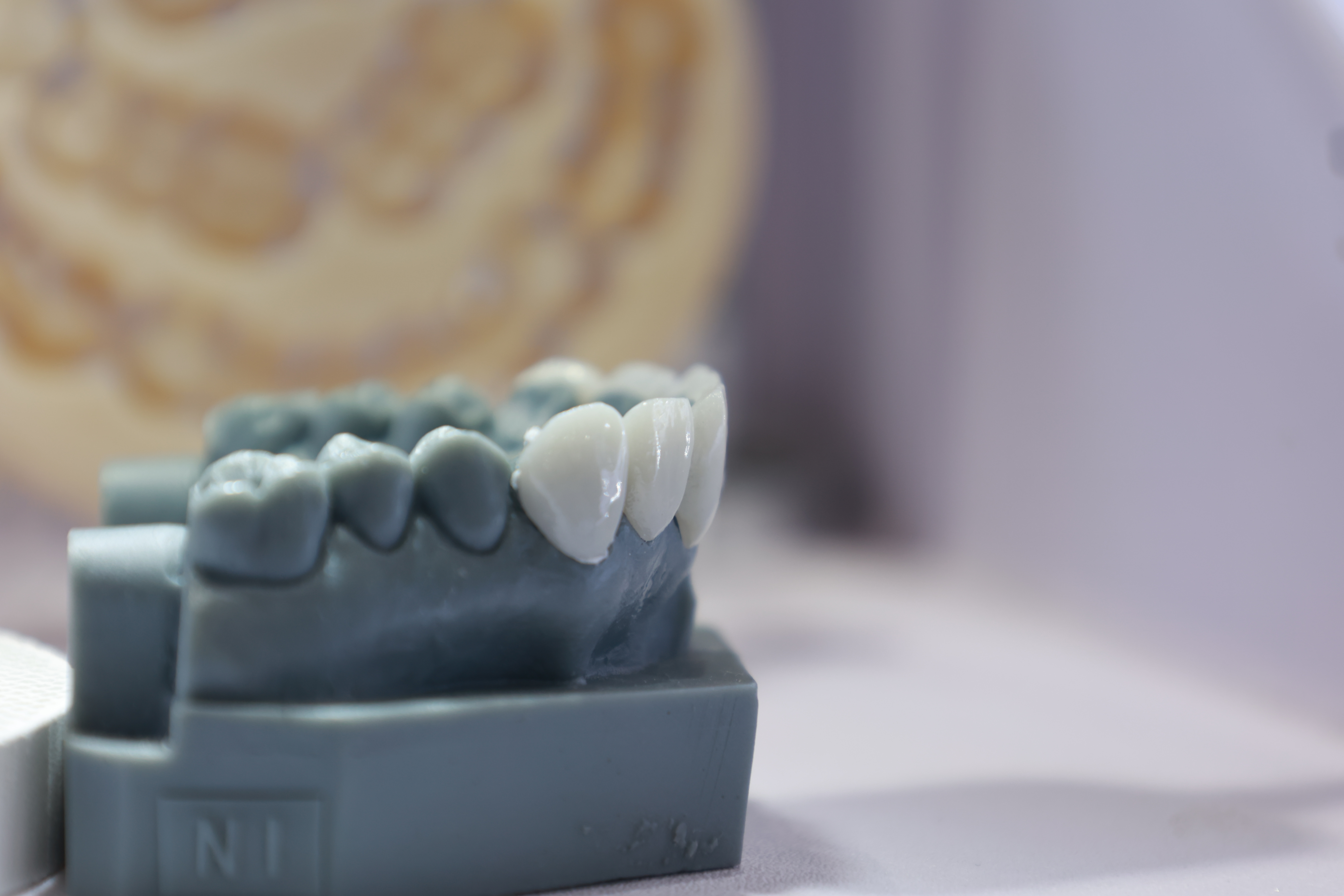 white zirconia block case of denture