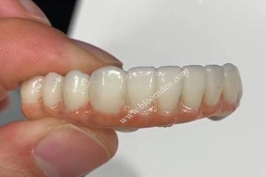 3D Pro Multi-layer Zirconia is for the Beauty in a Class of Aesthetics