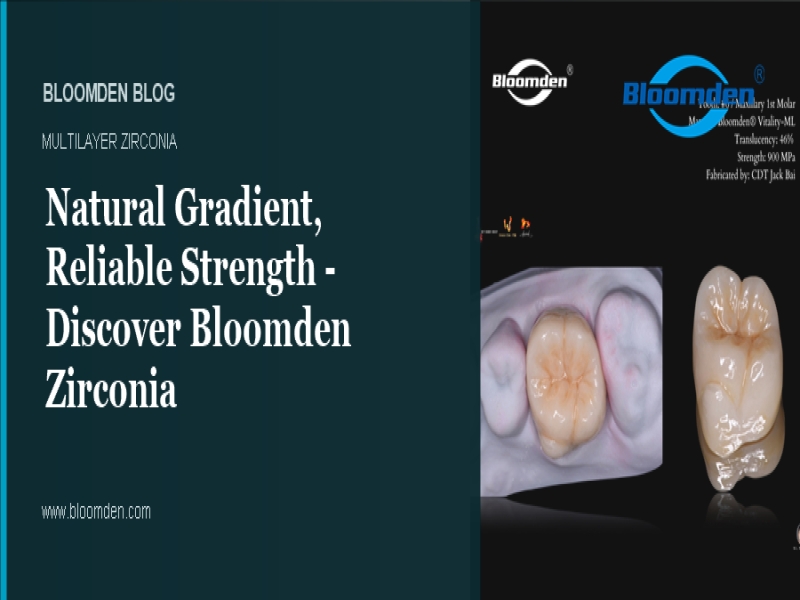 Natural Gradient, Reliable Strength — Discover Bloomden Zirconia