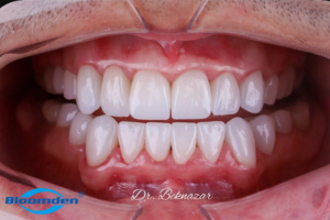 Bloomden Lumix cases - by Dr. Beknazar from Kyrgyzstan!