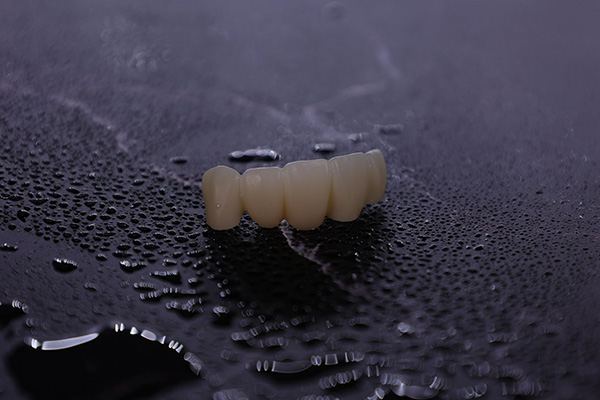 Several advantages of zirconia all-ceramic porcelain denture
