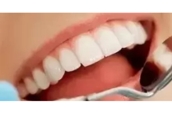 Dental Classfication
